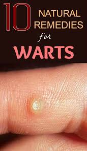 Contact Support Natural Wart Remedies Warts Get Rid Of Warts