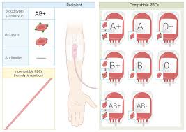 Blood donor bill of rights. Transfusion Amboss