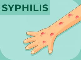 Image result for syphilis symptoms