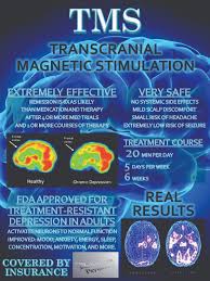 Take a look and see if your insurance has you covered. Redemption Psychiatry Transcranial Magnetic Stimulation Tms Information