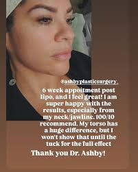 Ashby Plastic Surgery (@ashbyplasticsurgery_) · Layton, UT