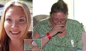 Woman survives flesh-eating bacteria she caught from a spider bite