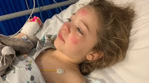 Mum shaves head after daughter is diagnosed with brain tumour