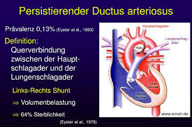Keine lehrstelle, keine freundin und eine clique, die ihn nicht ernst nimmt. Ppt Persistierender Ductus Arteriosus Pda Und Der Pon Im Speziellen Powerpoint Presentation Id 4891666