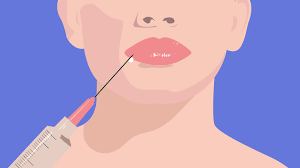 Can i get rid of my labiomental fold? Our Guide To Facial Fillers From Treatment Options To Recovery Time Allure