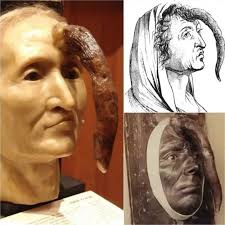 A bizarre 19th-century woman with a 9.8-inch male penis growing from her  forehead is now
