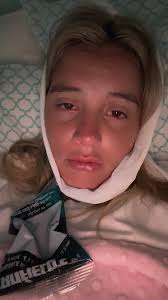 Iris Kendall Surgery