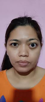 Fundraiser by Maritoni Bermejo : Please support Mary's Brain Surgery &  Recovery