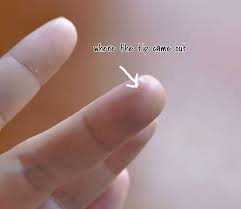 My Latest Sewing Injury Needle Through A Finger Sewcanshe Free Sewing Patterns Tutorials