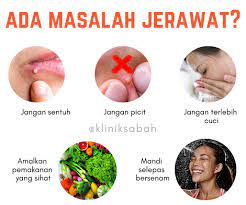 Penjagaan kulit wajah lelaki mahupun wanita di setiap negara adalah berbeza mengikut keadaan ini juga adalah salah satu cara untuk menjaga kulit muka daripada jerawat kerana muka yang bersih. Penjagaan Muka Klinik Sabah