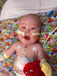 Owen's Lung Issue and Potential Bronchoscopy