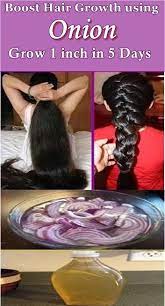 Onion For Hair Growth Grow 1 Inch In 5 Days Reduce Hair Loss Boost Hair Growth Onion Hair Growth