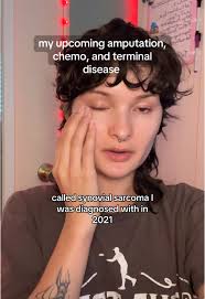 Sarcoma Knee Pictures