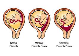 Pin On Baby Birth