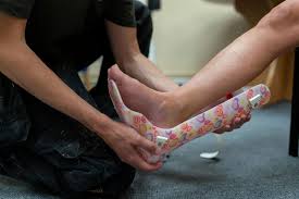 Image result for Orthotic