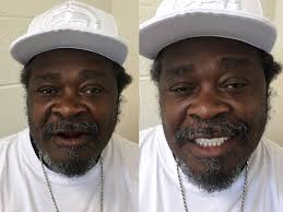 For Patients — D-DENT