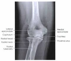 Image result for Elbow XRay
