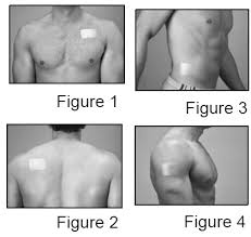 Fentanyl Transdermal System Fentanyl Transdermal System For