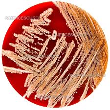 Image result for yersinia fotos