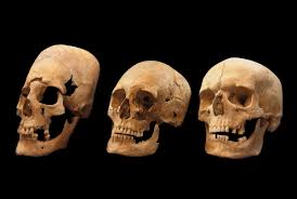 Why Did These Medieval European Women Have Alien Like Skulls Live Science Elongated skulls are seen by most ufologists as proof of the alien origin of the human race. why did these medieval european women