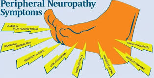 Image result for Peripheral Neuropathy