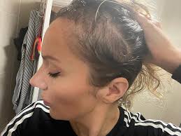 My thinning middle-aged hair left me in despair. Then I hit