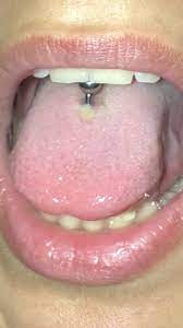 Der käuferschutz ist deine absicherung, wenn eine ware nicht ankommt, beschädigt ist oder nicht der beschreibung entspricht. Ist Mein Piercing Irgendwie Entzundet Zungenpiercing Piercingstudio Piercing Stechen