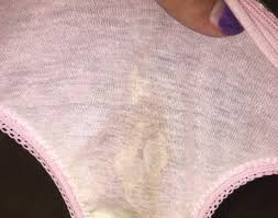 Maybe you would like to learn more about one of these? Is This Amniotic Fluid Leak Or Urine Tmi Picture Included March 2018 Babycenter Australia
