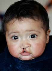 Partners in Care The Mission of M.O.S.T.