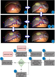 Maybe you would like to learn more about one of these? Combining Visual Cues With Interactions For 3d 2d Registration In Liver Laparoscopy Springerlink