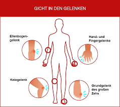 Harnsaure Naturlich Senken Mit Montmorency Sauerkirschen
