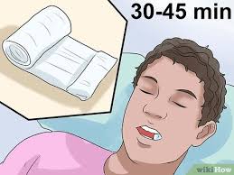 كيفية تنظيف أسنانك بعد خلع ضرس العقل صور توضيحية Wikihow