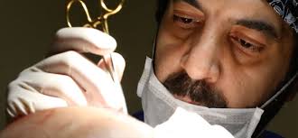 Perchè è così famoso il trapianto di capelli in turchia? Trapianto Di Capelli In Turchia I Numeri Di Un Fenomeno In Crescita Milanofinanza It