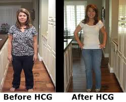 Pin On Hcg Before Afters