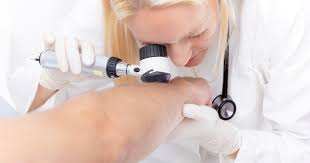 White Patches Symptoms Causes Treatments