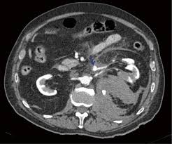 Image result for Genitourinary Trauma