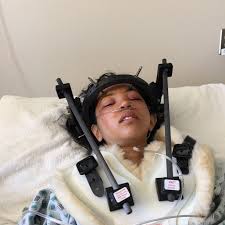 The Cost Of Getting Seriously Injured And How To Be Financially Ready For It Keeping My Head Up High