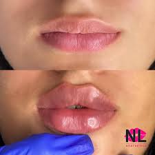 Nicole Lucia Aesthetics Manchester United Kingdom Facebook