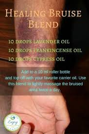 Essential Oils For Bruises Essential Oils For Bruises Have You Tried Eos For Bruising Enjoy Natural Health Essential Oil Blends Essential Oils Essential Oils Health