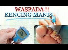 Maybe you would like to learn more about one of these? Petua Hilangkan Kencing Manis å¸å­ Facebook