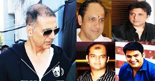 5 Actors Who Have Become Bald In Real Life Some legendary bollywood actors are completely bald today, thereby, sporting a bald, shaved head look. 5 actors who have become bald in real life