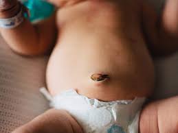 It's usually a minor problem that looks worse than it is. The Umbilical Cord Fell Off What Should I Do