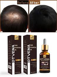 18 ogx moroccan argan oil shampoo. Pin On Otvena Natural Anti Hair Loss Beard Nourishment Oi