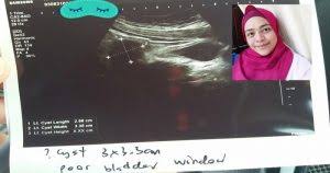 Ketika merawat anak kucing dari kecil dan tanpa induk memang memerlukan ketekunan selama beberapa bulan pertama. 9 Tanda Rahim Tak Sihat Jangan Biar Sampai Peranakan Jatuh Vanilla Kismis