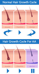 Skin diseases affecting the scalp: The Different Types Of Autoimmune Alopecia