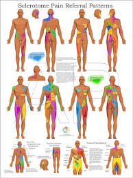 Pin On Body Pain