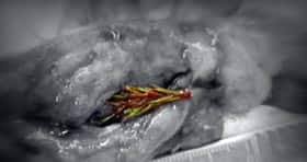 I do some home growing with a variety of trees and other plants and you are generally right that the amount of live mass above the ground is equal to what is below. Did Fir Branch Prick A Lung Cbc News
