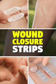 Zip Stitch Easy Wound Closure Strips No More Stitches And Laceration Kit Thesuperboo Medical Survival Essentials Medical Equipment