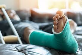 Image result for Foot Fracture