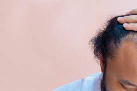 الشعر الخفيف عند الرجال أسباب وطرق للعلاج من المساج إلى الشامبو المصري اليوم